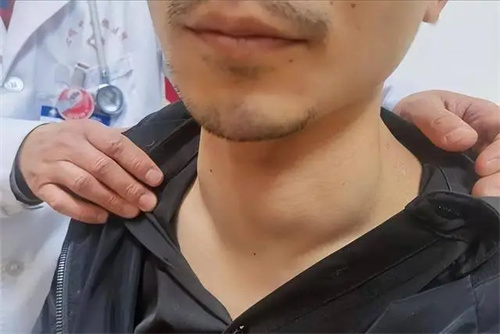 图片细节
